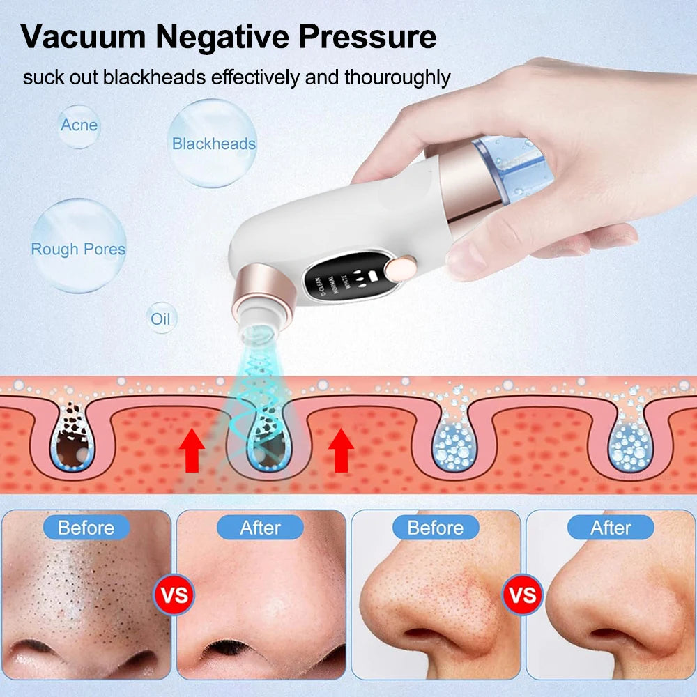 Blackhead Remover Black Dots Vacuum Cleaner Facial Pore Cleaner Deep Cleaning Black Dots Remover Pimple Acne Blackhead Removal