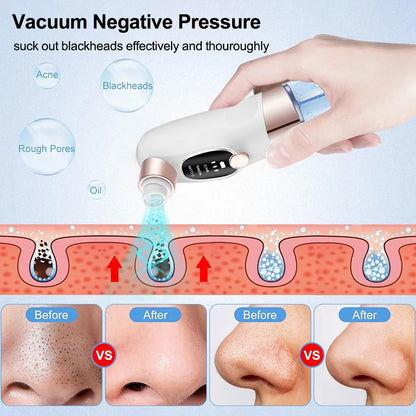 Blackhead Remover Black Dots Vacuum Cleaner Facial Pore Cleaner Deep Cleaning Black Dots Remover Pimple Acne Blackhead Removal