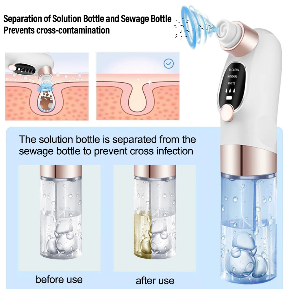 Blackhead Remover Black Dots Vacuum Cleaner Facial Pore Cleaner Deep Cleaning Black Dots Remover Pimple Acne Blackhead Removal