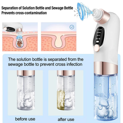 Blackhead Remover Black Dots Vacuum Cleaner Facial Pore Cleaner Deep Cleaning Black Dots Remover Pimple Acne Blackhead Removal