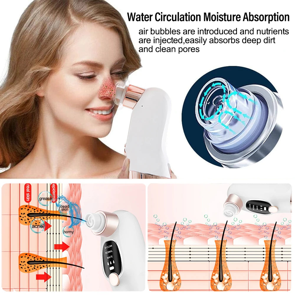 Blackhead Remover Black Dots Vacuum Cleaner Facial Pore Cleaner Deep Cleaning Black Dots Remover Pimple Acne Blackhead Removal