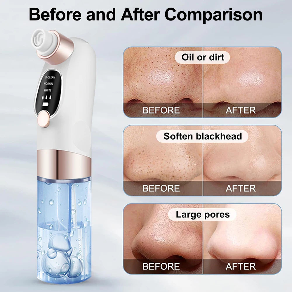 Blackhead Remover Black Dots Vacuum Cleaner Facial Pore Cleaner Deep Cleaning Black Dots Remover Pimple Acne Blackhead Removal